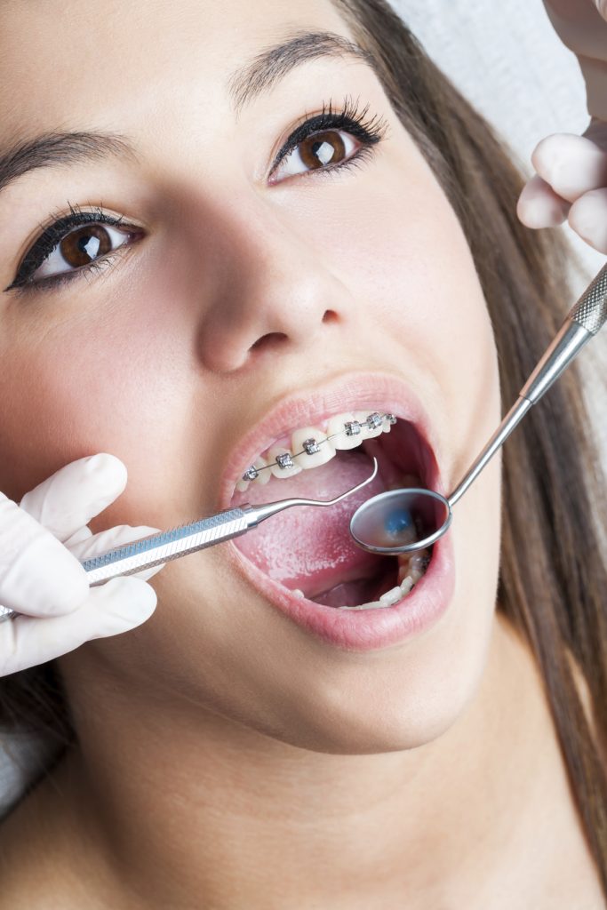 Woman having teeth examined by dentist