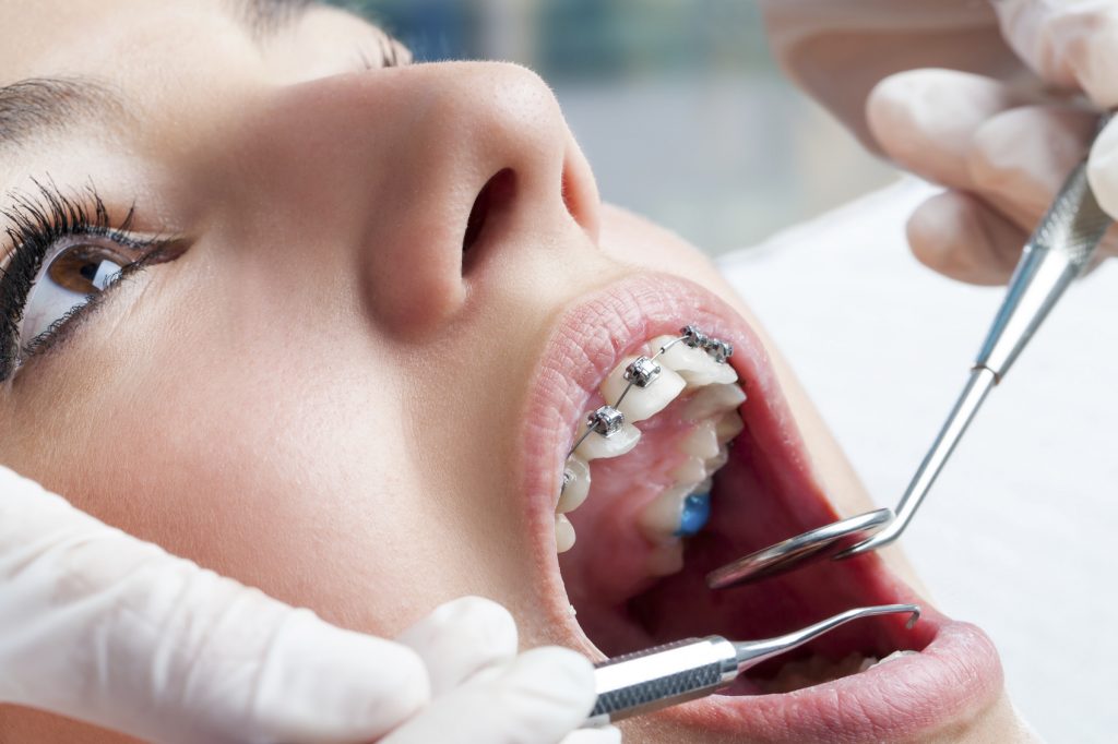 Person getting teeth examined by dentist