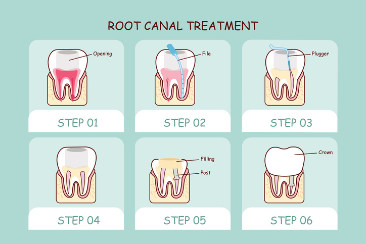 Dentist Trumbull | Dentist In Fairfield | Dentist In Bridgeport | Dentist In Westport | Dentist In Weston