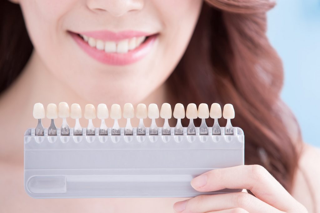 Woman smiling holding teeth shades