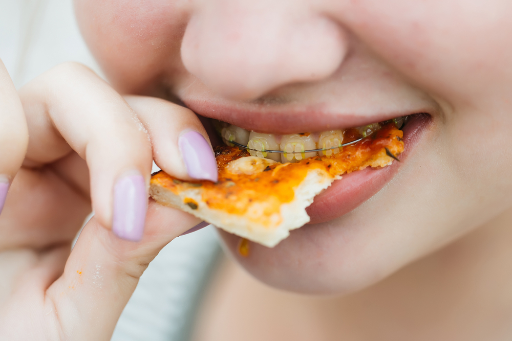 Woman with braces eats pizzia