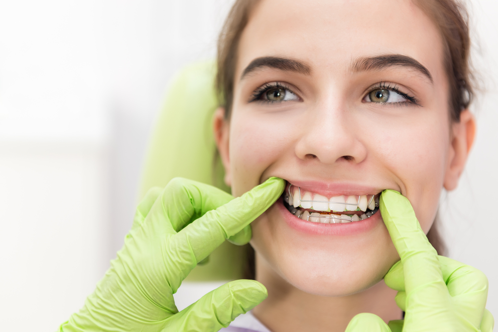 Dentist fitting retainer to womans teeth