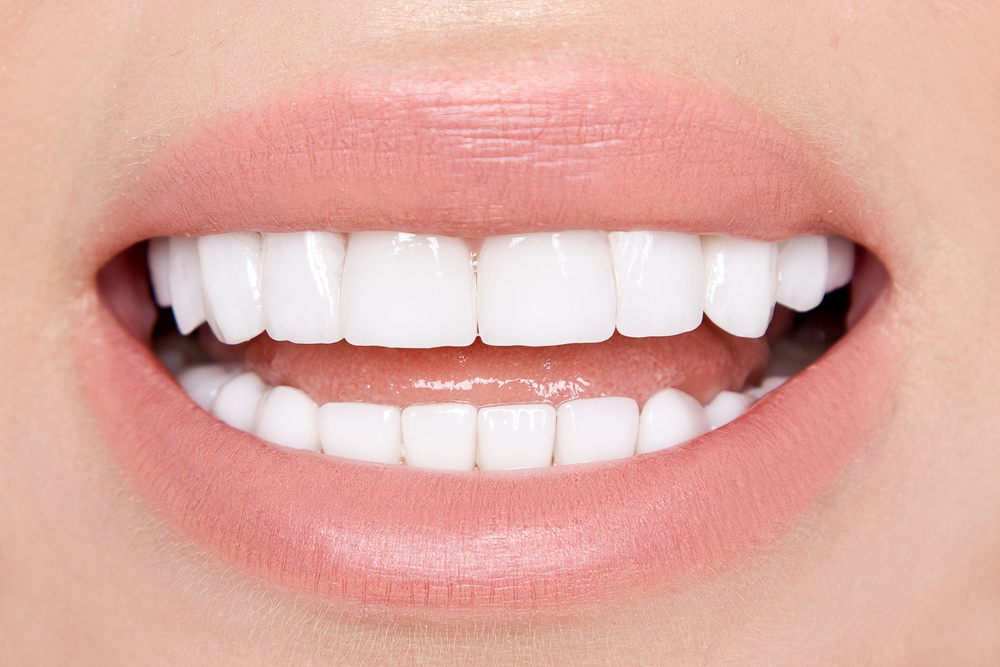 Person smiling showing teeth