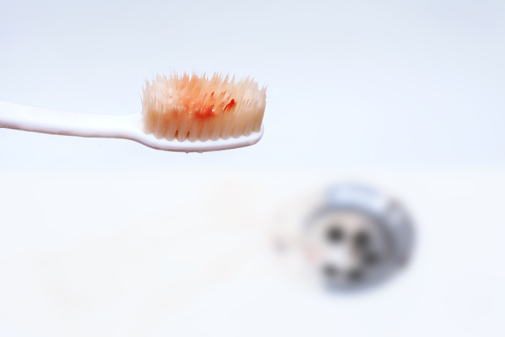 Blood from bleeding gums on toothbrush