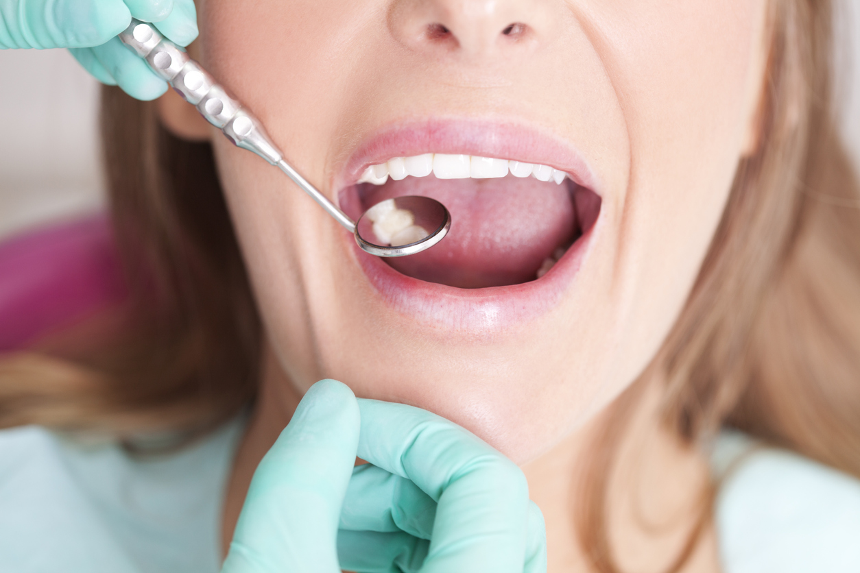 Female patient with open mouth receiving dental inspection at dentist's office