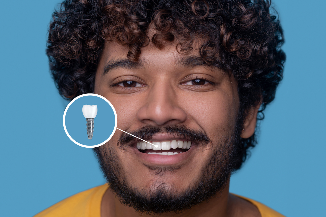 Headshot of a happy attractive guy with open mouth showing his white teeth before the camera