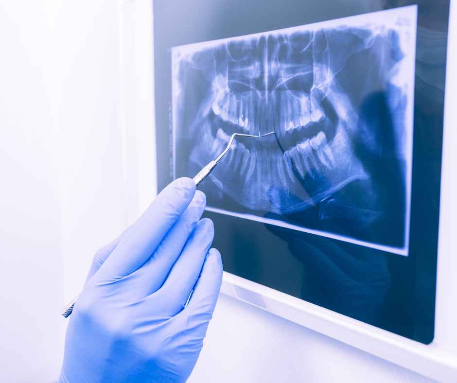 A dentist reviewing an x-ray of a patient's mouth
